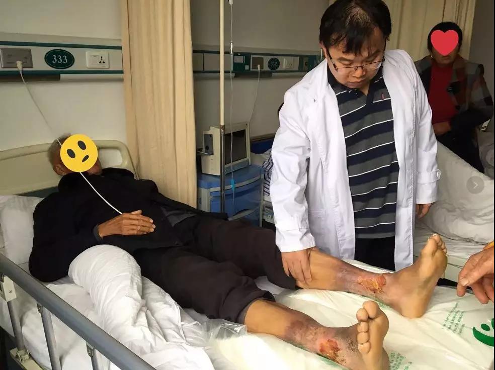 歐教授“周三教授親診日”，10名靜脈曲張幸運者得到診治！